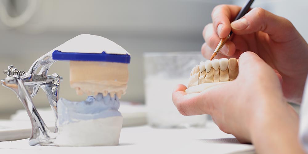 Protesi dentarie a Torino e Novara